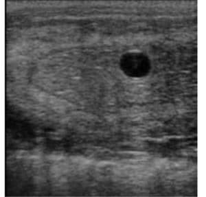 Ultrasound image of an embryo at day 14.