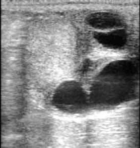 Ultrasound image of a corpus luteum, after the mare has ovulated. 