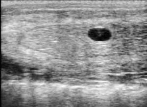 Ultrasound image of  an embryo at day 14. 