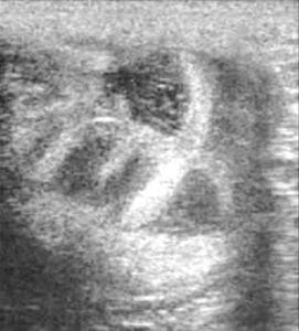 Ultrasound image of a uterus with good oedema, in the lead up to insemination.